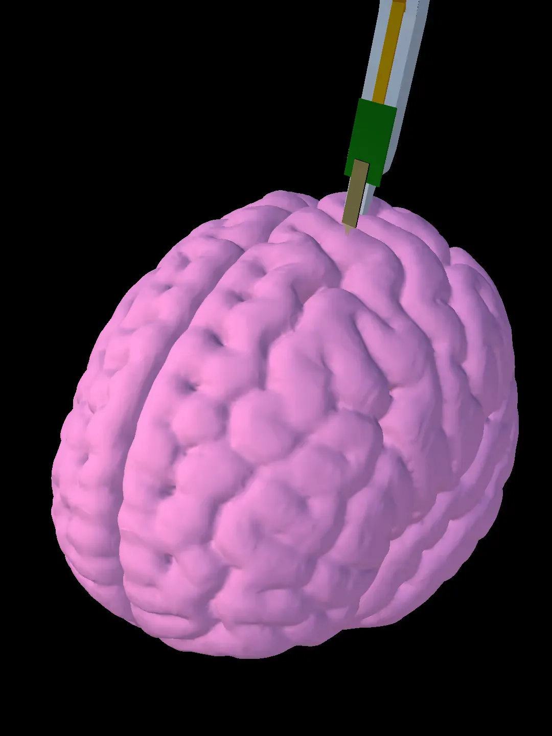 Human brain with electrophysiology probe