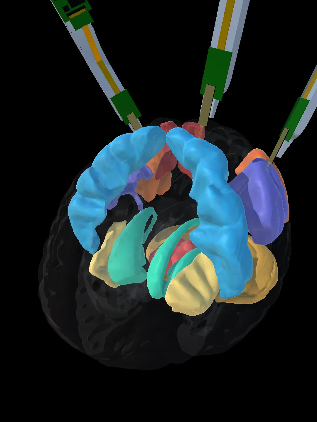 Human brain with 3 electrophysiology probes and multiple regions